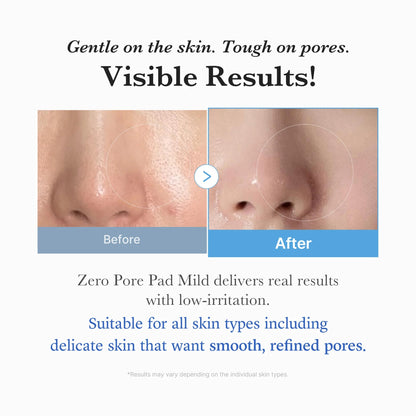 DCARE Pore Refining Pads